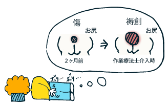 褥創(床ずれ)出現