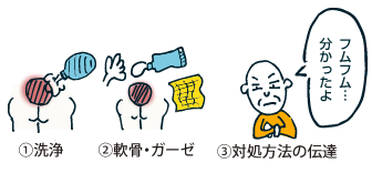 処置の内容